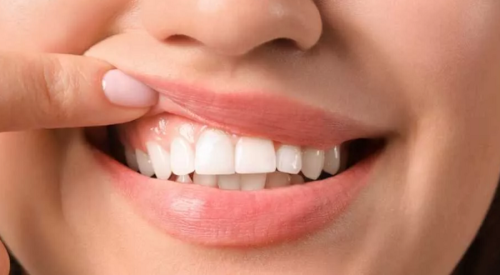 افضل دكتور امراض لثة في جدة
