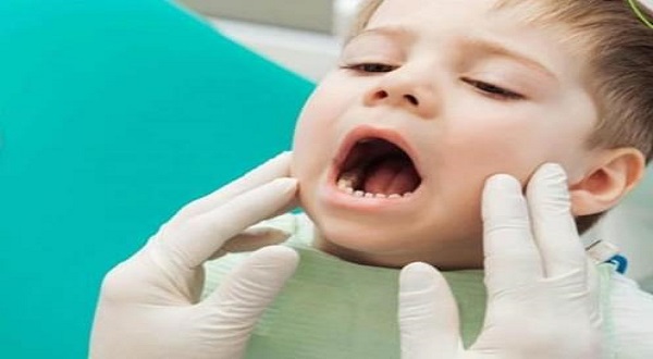 (7) من اهم اسباب خراج الاسنان عند الاطفال، وكيفية علاجه